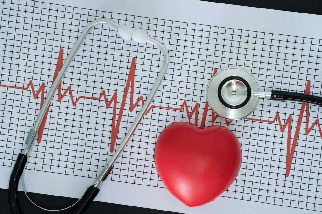 Langzeit EKG des Herzens